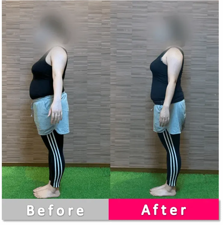 女性会員のビフォー・アフター写真（側面）